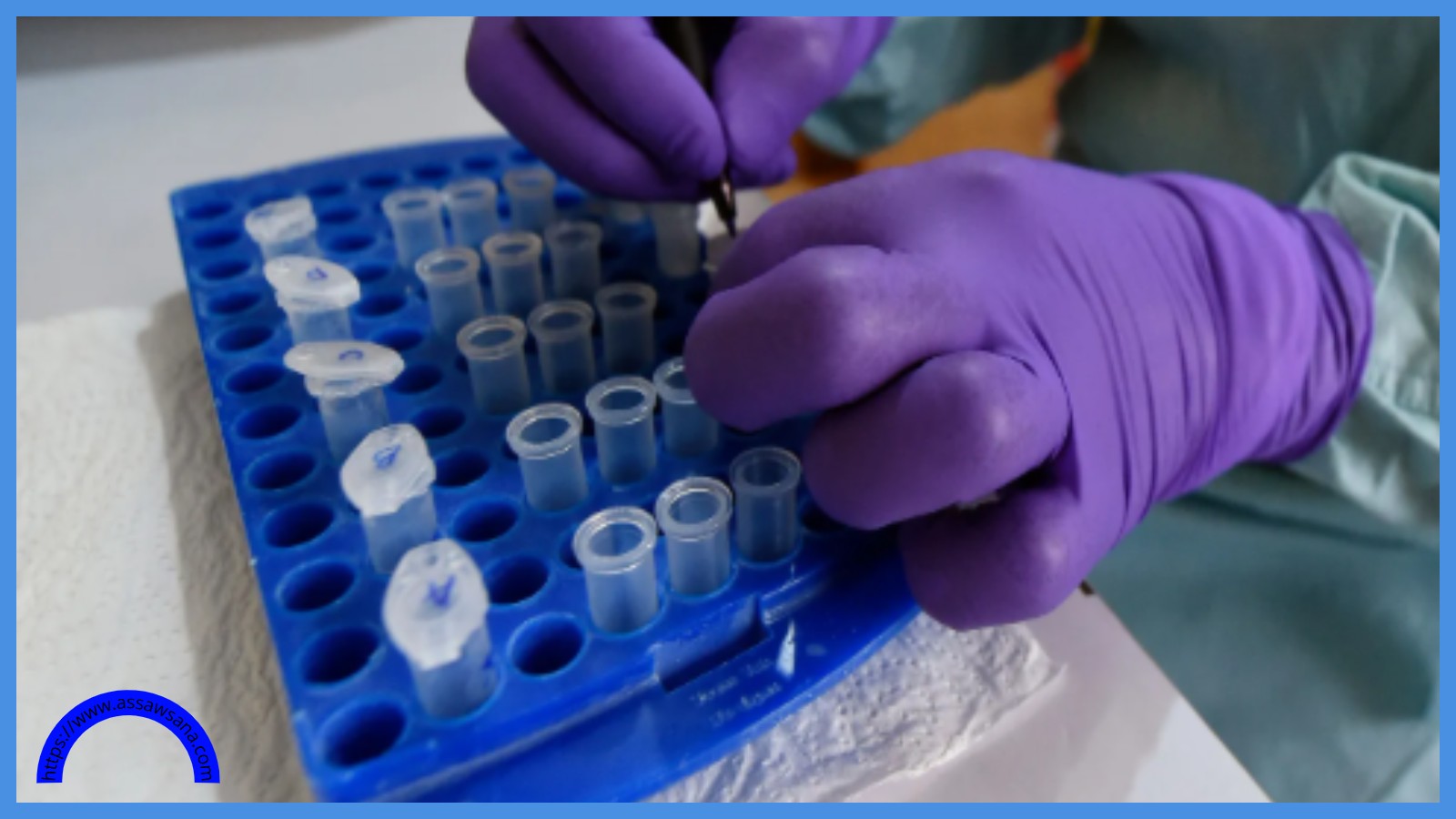 ما هي متلازمة غيلان باريه التي أودت بحياة 3 أشخاص بغزة