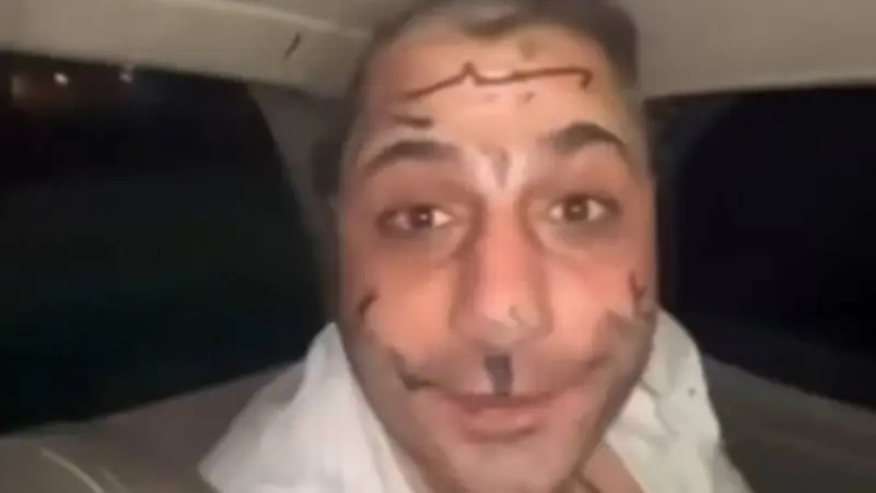 فيديو مثير لاعتداء على مطرب شعبي يُشعل سوريا