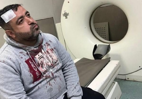 الاعتداء على صحفي في الزرقاء والنقابة تتابع ..  فيديو