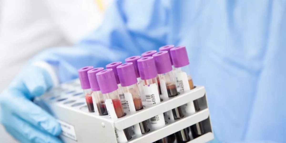 الفحوصات المخبرية تؤكد سلامة 46 مخالطاً لحالة السحايا في الطفيلة