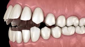 أسباب ألم الفك تعرف عليها