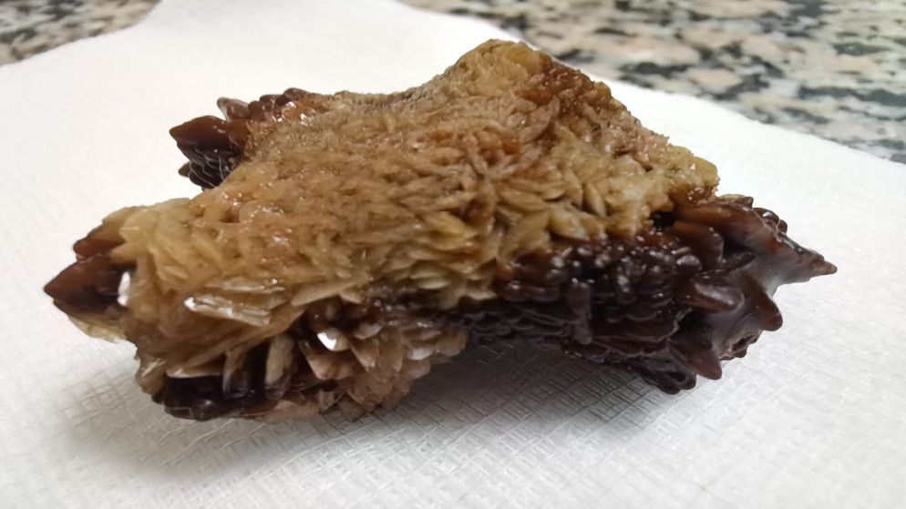 إجراء أول عملية نوعية بالمنظار لإزالة حصوة كلى في مأدبا