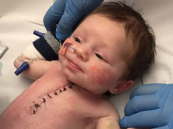 نجاح عملية دقيقة لانقاذ طفل رضيع