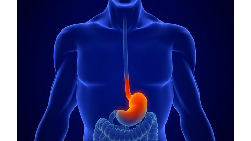 طرق التعامل مع الارتجاع المعدي المريئي خلال الصيام