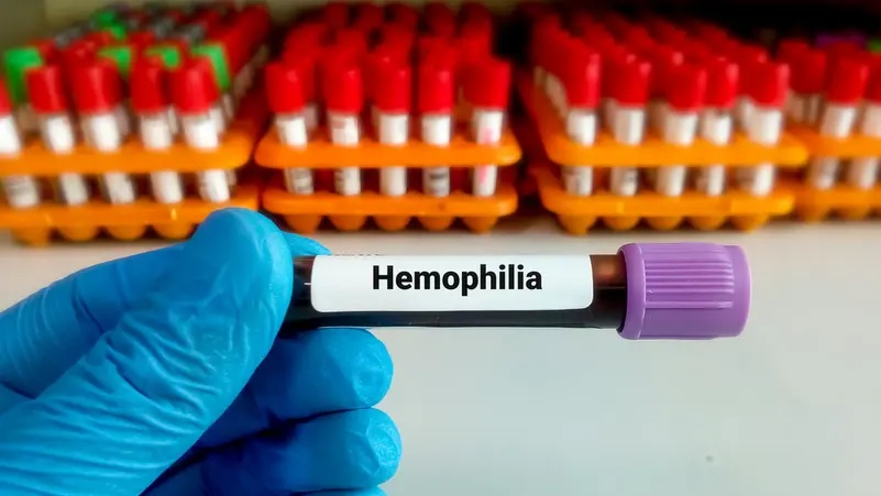 7 فحوصات دم ضرورية بعد سن الأربعين