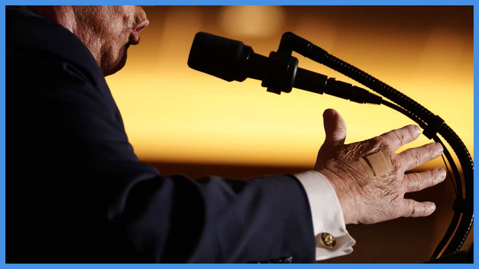 ما سر الضمادة على يد ترامب ..  البيت الأبيض يوضح