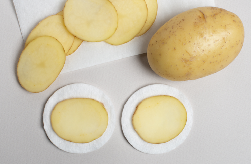 البطاطا  ..  كنز حقيقي للعناية بالبشرة