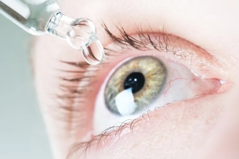 جفاف العين ..  الأسباب الشائعة وطرق الوقاية الفعالة