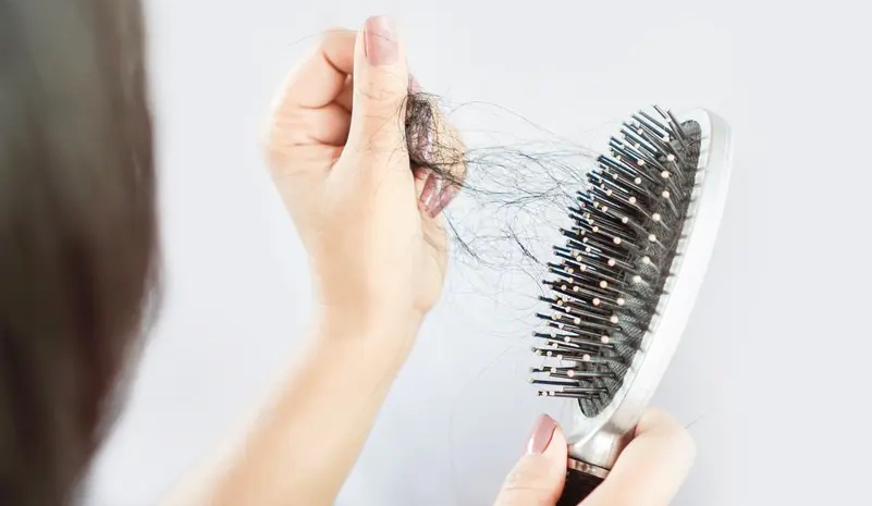 نقلة نوعية في علاج تساقط الشعر دون جراحة