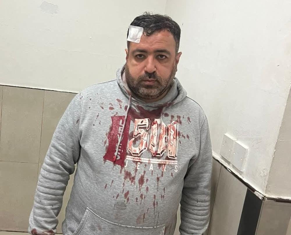 الأجهزة الأمنية تحقق بجريمة الاعتداء على الصحفي التميمي