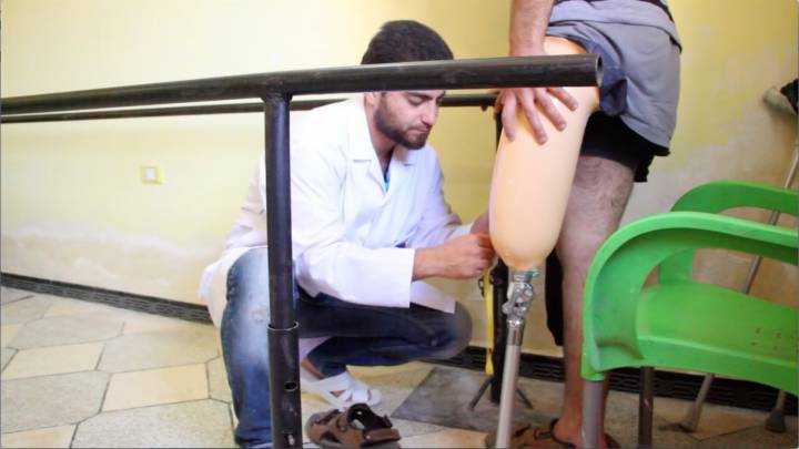 صحة غزة تطلق خطة لإعادة بناء تخصص جراحة التجميل والترميم 