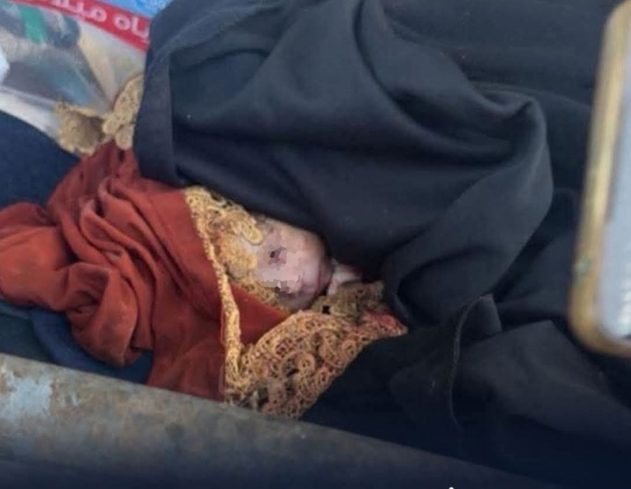 العثور على طفل رضيع داخل حاوية بالكرك