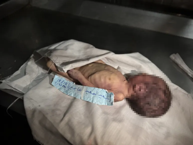 غزة تحت القصف والبرد  ..   الأطفال أول الضحايا