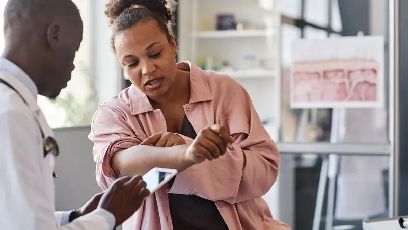 علاج جديد مبتكر بالضوء للصدفية بلا آثار جانبية