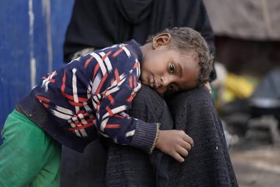 الصحة العالمية: 1574 قتيلا و6939 مصابا في اليمن منذ أغسطس
