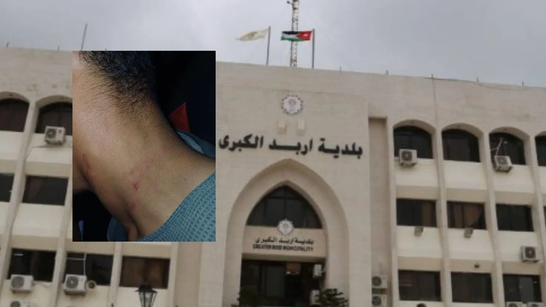 اعتداء على عامل وطن أثناء أداء واجبه في إربد 
