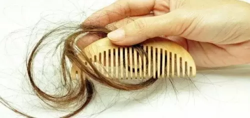علاج تساقط الشعر الموسمي 