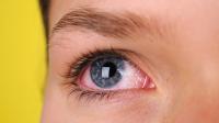 علامة"نادرة" لسرطان مميت تظهر في العينين