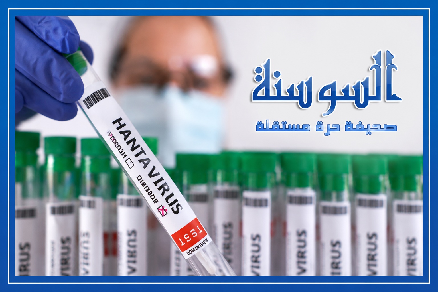 الهانتا فيروس ..  أسبابه وأعراضه وطرق الوقاية منه