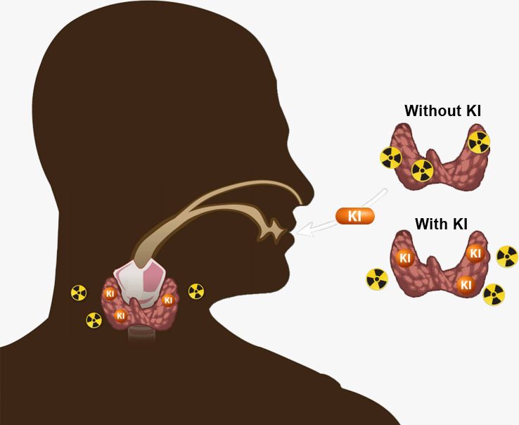 يوديد البوتاسيوم ودوره في الوقاية من مضاعفات الإشعاع النووي