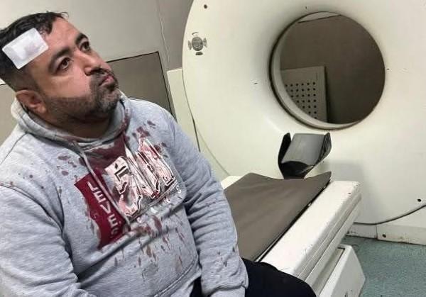 ضبط المعتدين على الصحفي التميمي في الزرقاء