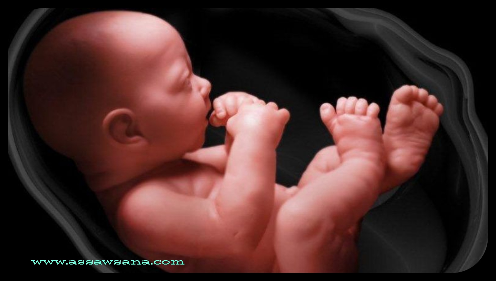 ما هو بزل السلى 