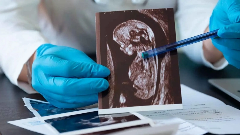 صدمة في الأرجنتين عقب اكتشاف حمل طفلة في سن العاشرة