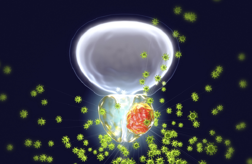 تلوث الهواء يزيد خطر الإصابة بسرطان البروستات بنسبة 6.9%