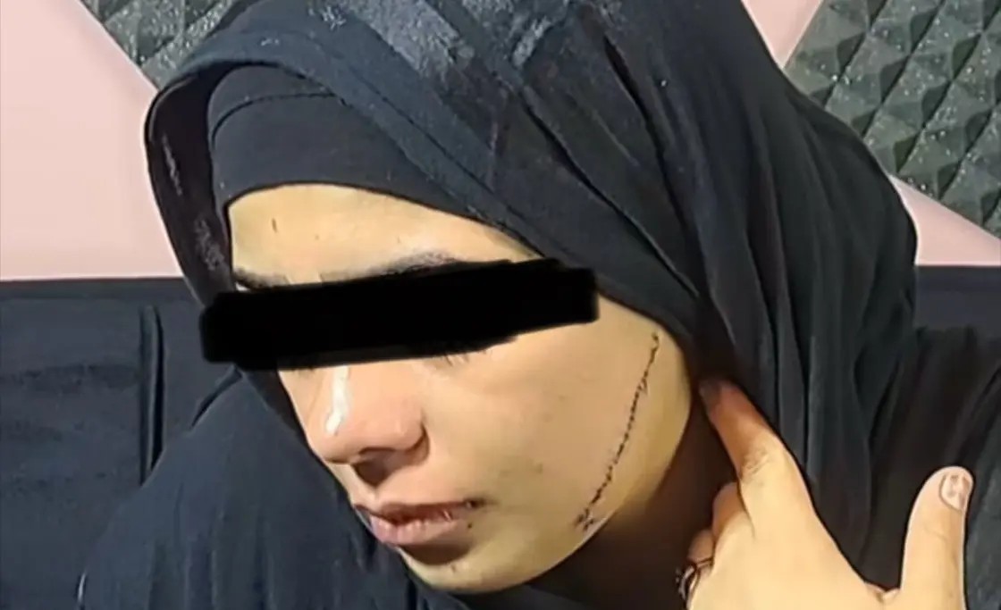 تشويه وجه عروس في الشارع يهز القاهرة