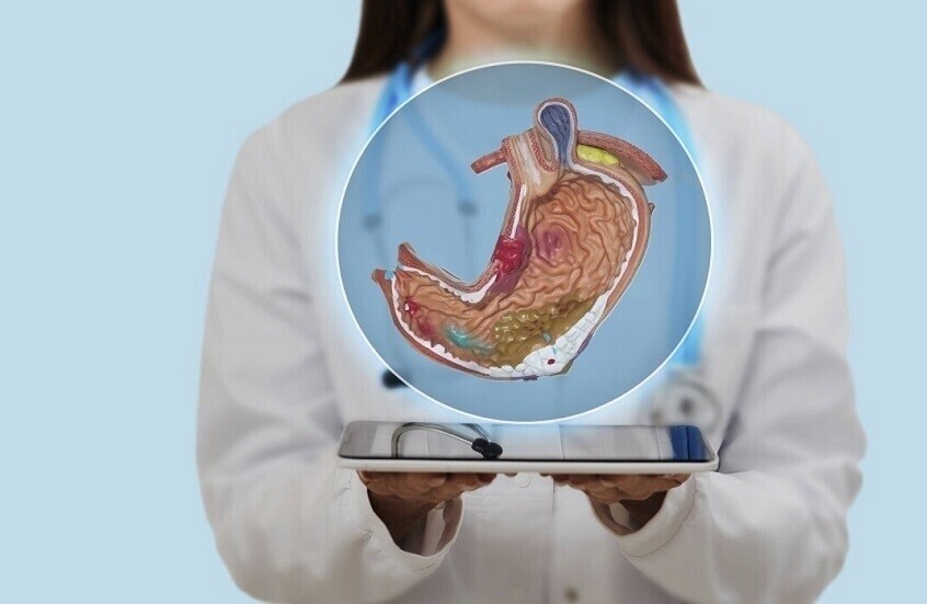 طعمة تزيد خطر الإصابة بقرحة المعدة