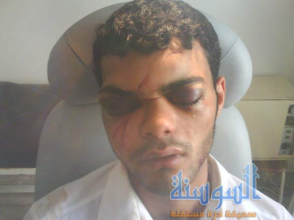 مستشفى اليرموك لشاب تكسر وجهه : روّح ما فيك إشي !