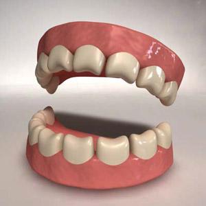  الأردن : طبيب يقوم بحفر طقم أسنان اصطناعي !! 