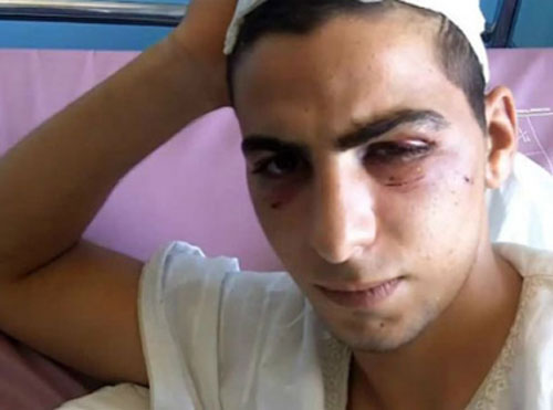  فريق تحري للوقوف على ملابسات ادعاء القلالوة 