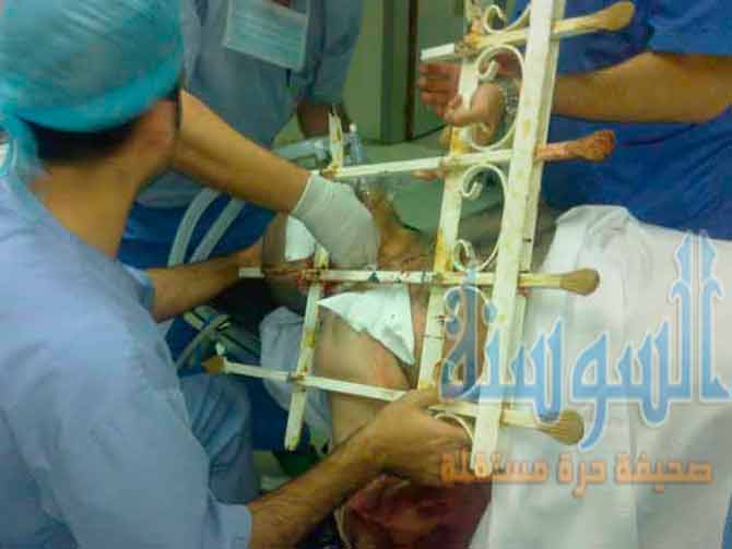  انقاذ اردني من موت محقق  ..  شاهد الصور