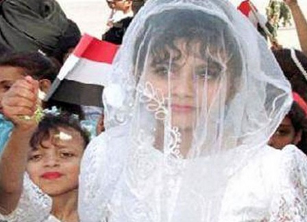 هل ماتت الطفلة اليمنية روان ليلة زفافها؟