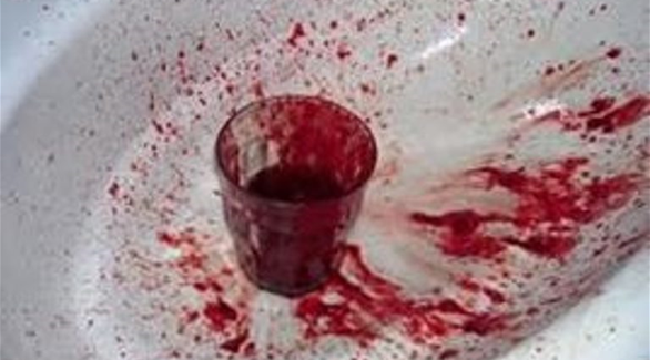 يشرب كوباً من دم زوجته يومياً طوال 3 سنوات