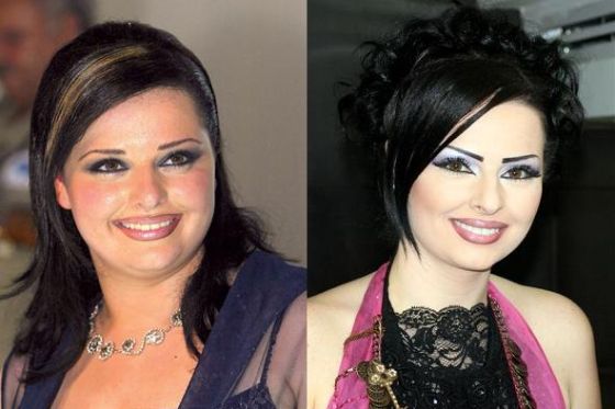 فنانون عرب قبل وبعد فقدان وزنهم  - صور