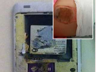 بالصور  ..  هاتف ذكي ينفجر في بنطال طفلة  ..  والنتيجة!