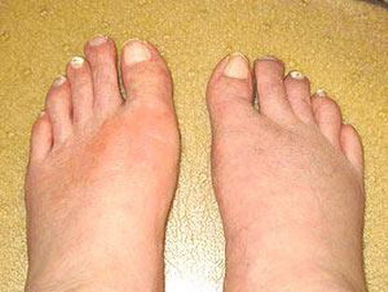 mainThumb