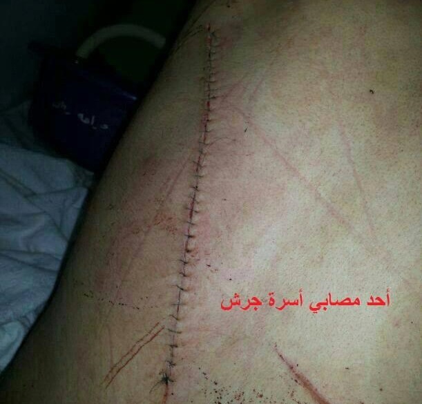 بالصور - معركة بالسيوف في قسم الجراحة بمستشفى جرش !