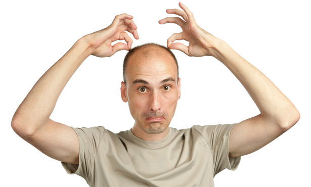 كيف تتخلص من الصلع  .. ؟
