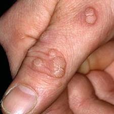 mainThumb