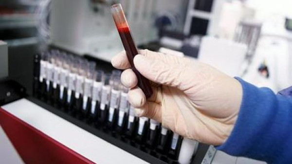 إصابة عدد من الكوادر الطبية بـإيبولا في سيراليون