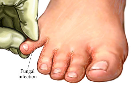 mainThumb