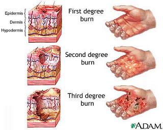 mainThumb