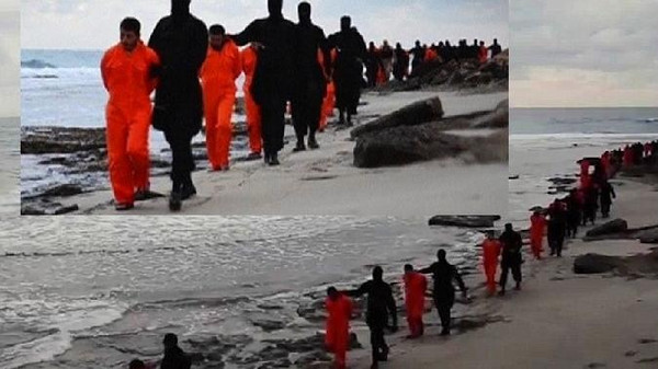 طبياً ..  ماذا يحدث لضحايا داعش عند ذبحهم أو حرقهم؟