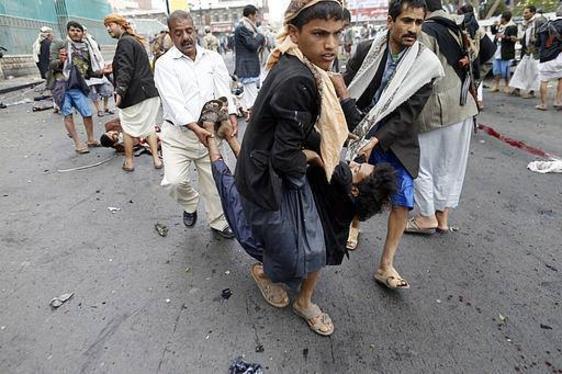 صنعاء : 142 قتيلا وداعش يتبنى التفجيرات