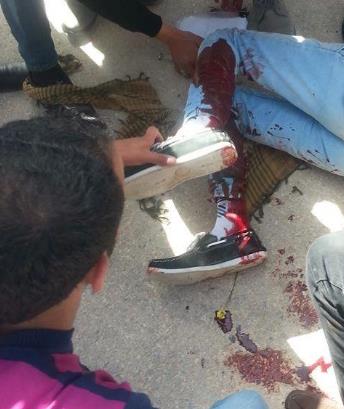 تحديد هوية مطلقي النار على طالب في آل البيت