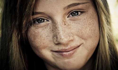 قناع بطاطا للتخلص سريعاً من النمش