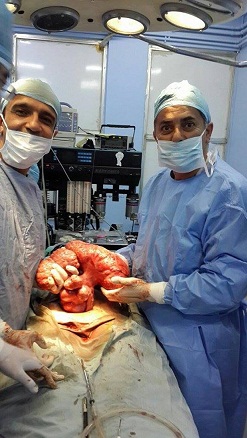 البشير ..  إستئصال ورم وزنه 12 كيلو غراما